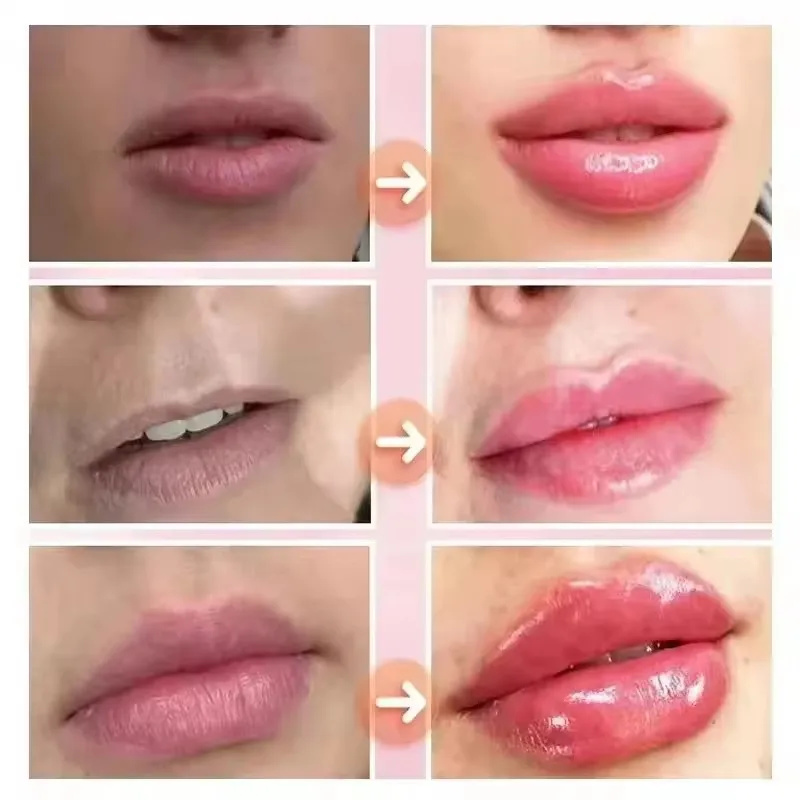 Anında Dudak Dolgunlaştırıcı E - Lip Gloss Plumping incelemesi ve fiyatı