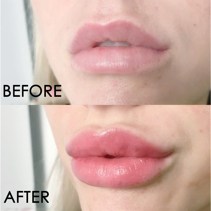 Dudak Bakım Serumu Anında Haci - Lip Gloss Plumping incelemesi ve fiyatı